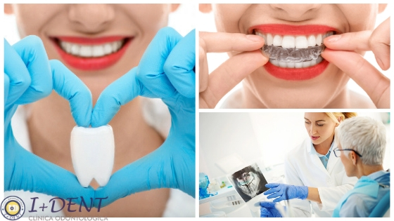 Estos son los principales problemas dentales que más deberían preocuparte